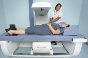 Importance of bone density testing for early detection