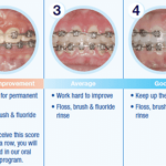 How to care for braces and orthodontic appliances