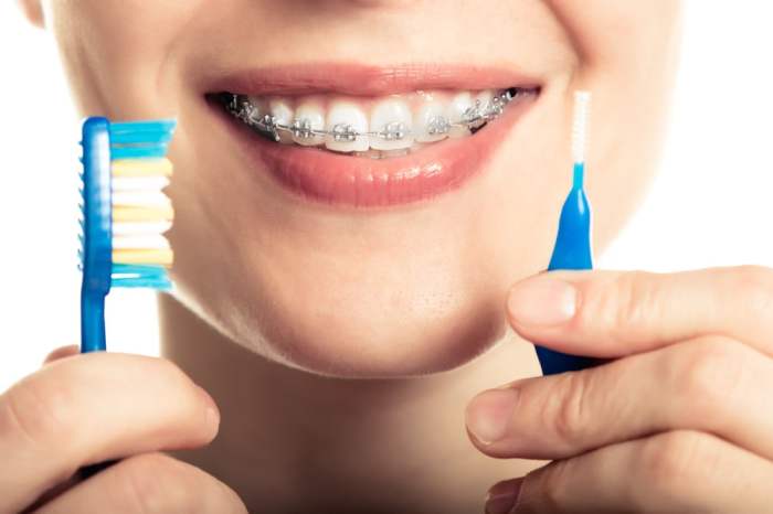 How to care for braces and orthodontic appliances